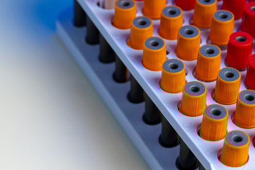 Blood test tubes in lab close up photo
