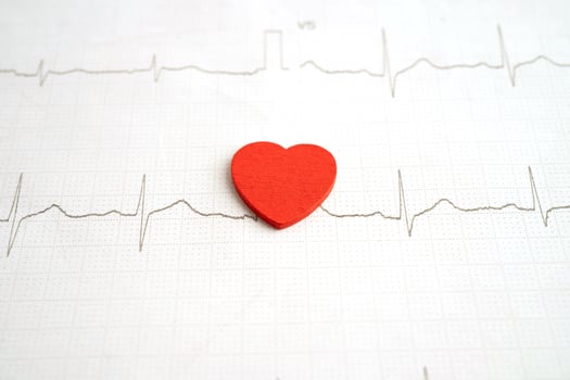 Electrocardiogram ECG, heart wave, heart attack, cardiogram report. photo