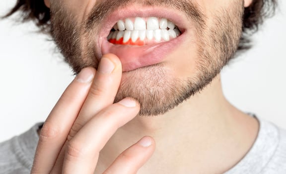 Cropped man suffering from toothache, tooth decay or sensitivity, close up photo