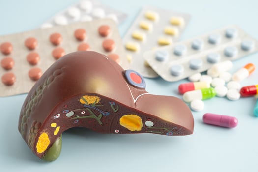 Liver model with pill drug treatment, Cirrhosis, Liver cancer, fatty liver. photo