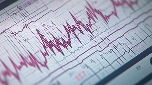Close-Up ECG Graph Showing Detailed Monitoring of Heart Activity Signals photo