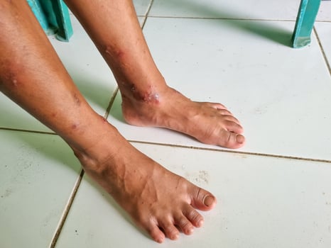 Allergic reactions, itchy skin on the feet to sores on the child's feet, itching and other skin manifestations, Conditions of the Feet and Feet, skin problems on general physical and emotional well-be photo