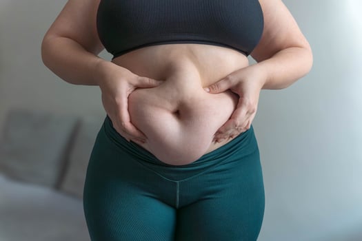 Close up tummy of a woman with fat belly photo