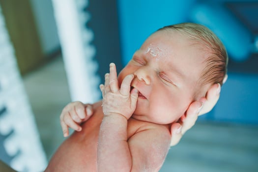 The baby is sleeping. A newborn baby is sleeping. Baby with dry skin photo