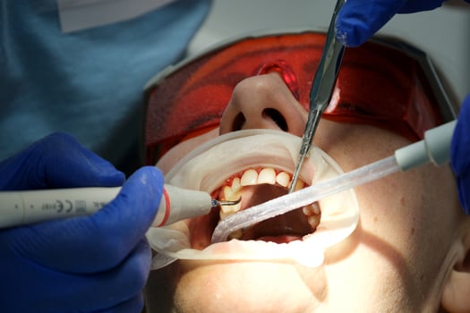 Close-up cropped shot of young woman at the dentist's chair during a dental procedure looking up and smiling. Dentist examining patient's teeth in modern clinic. Healthy teeth and medicine concept. photo