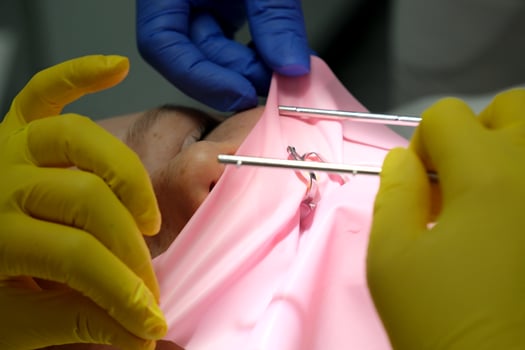 Dentist wearing eyeglasses gloves and mask examining a patient teeth with a dental probe and a mirror in a clinic box with equipment in the background photo