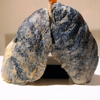 Evidence of damage on smoker lungs photo