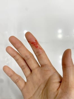 Finger with blood drop. Injured by sharp knife. photo