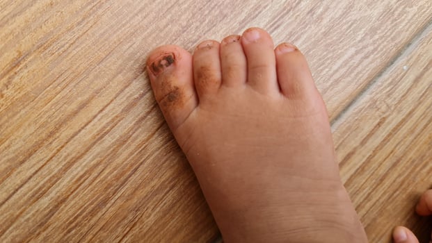 Close-up of a Child's Dirty Foot on a Wooden Floor photo