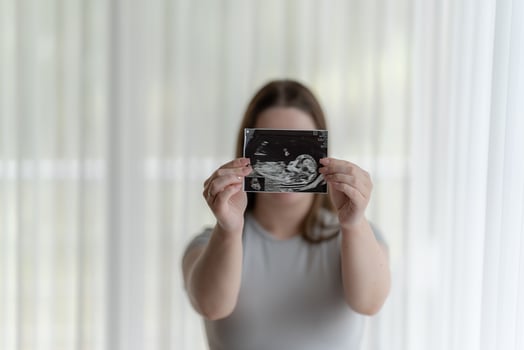 Happy Young Pregnant woman holding showing ultrasound scan photo of a fetus. Concept of pregnancy, Maternity prenatal care