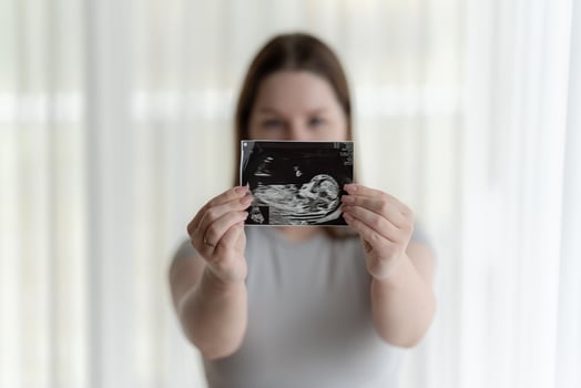 Gen Z pregnant woman holding showing ultrasound scan photo of a fetus. Concept of pregnancy, Maternity prenatal care