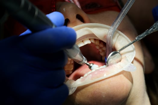 dental instruments Beautiful senior woman at dentist having dental treatment at dentist's office photo