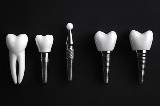Dental implants showing stages of implantation on black background photo
