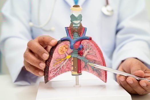 Pneumonia, lung cancer, Asian doctor holding human anatomy model for study diagnosis and treatment photo