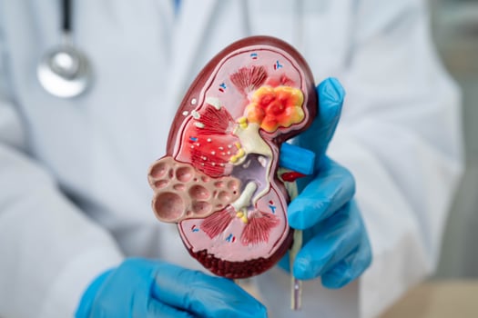 Chronic kidney disease, doctor with model for treatment urinary system, urology, Estimated glomerular photo