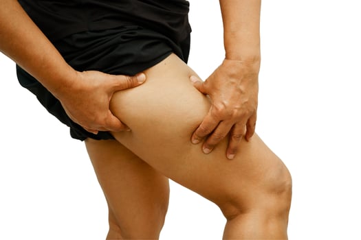 Asian woman with cellulite on leg skin fat, overweight problem isolated on white background. photo