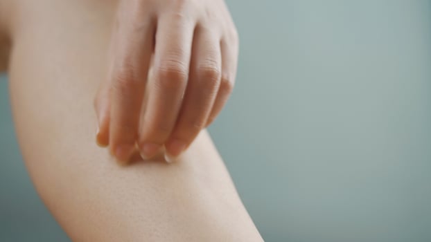 the arms and legs, symptoms of itchy skin, skin disease, allergies photo
