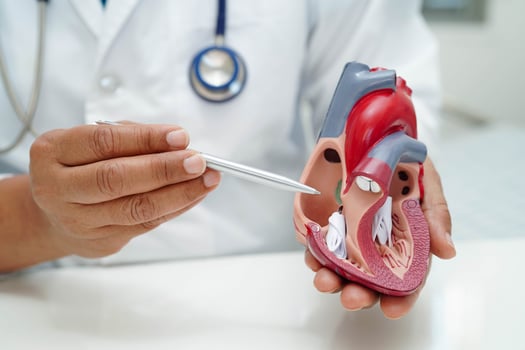 Cardiovascular disease CVD, doctor with heart human model anatomy for treatment patient photo