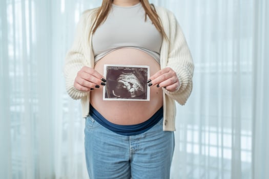 Pregnant woman holding ultrasound scan photo of a fetus in front of her belly in third trimester at home. Concept of pregnancy, sonography. Maternity prenatal care