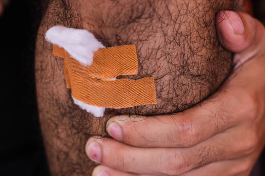 A close up image of a hairy leg with a gauze pad and two band-aids covering the wound, concept of wound care and self treatment. photo