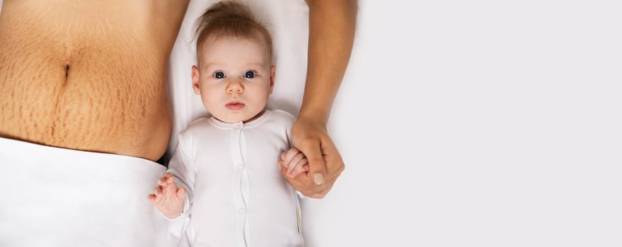 baby and stretch marks panoramic photo