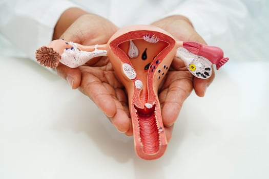 Uterus, doctor holding human anatomy model for study diagnosis and treatment in photo