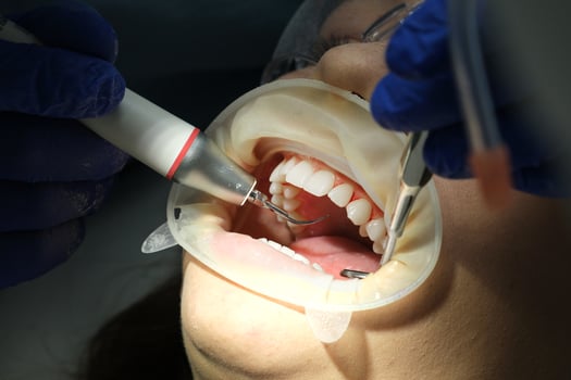 Dental assistant, Dental tools, Tooth check. Dentist in blue scrubs is examining patient's teeth with help from dental assistant in red scrubs. photo