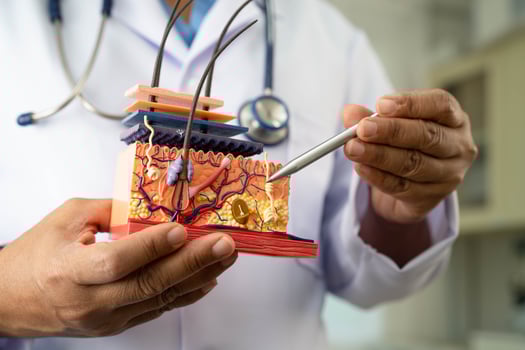Hair transplant, Asian dermatologist doctor holding skin structure anatomy model photo