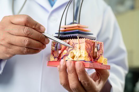 Hair transplant, Asian dermatologist doctor holding skin structure anatomy model for photo