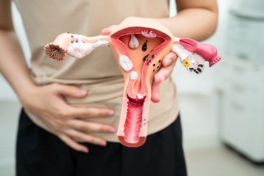 Uterus, Asian, woman holding photo