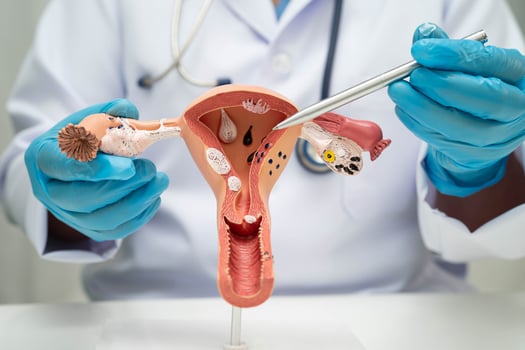 Uterus doctor holding human anatomy model for study diagnosis photo