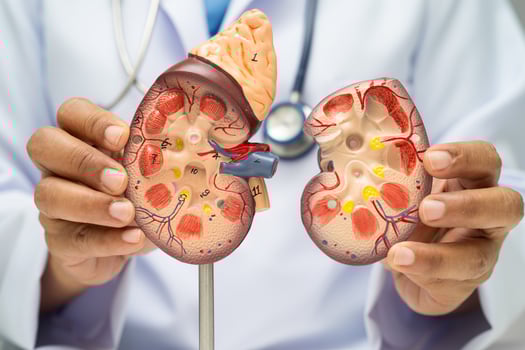 Chronic kidney disease model anatomy photo