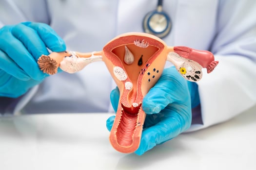 Uterus, doctor holding human anatomy model for study diagnosis and treatment in hospital. photo