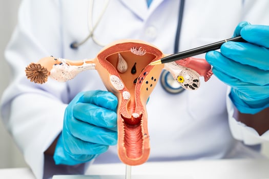 Uterus holding human anatomy model for study diagnosis and treatment in hospital. photo
