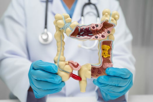 Intestine doctor holding human anatomy model photo