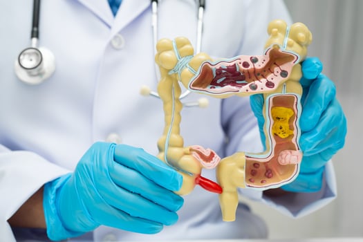 Intestine doctor holding human anatomy model for study diagnosis and treatment photo
