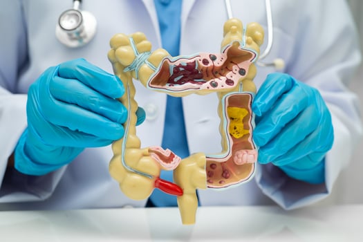 Intestine doctor holding human anatomy model for study diagnosis and treatment in hospital. photo