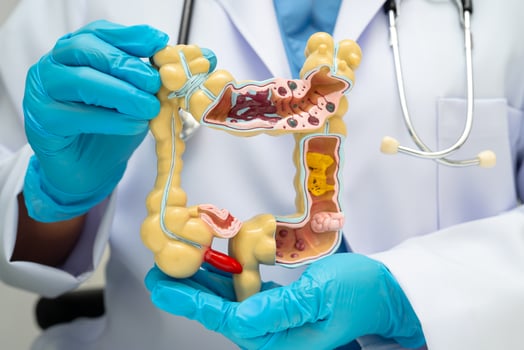 Intestine doctor holding human anatomy model for study diagnosis photo