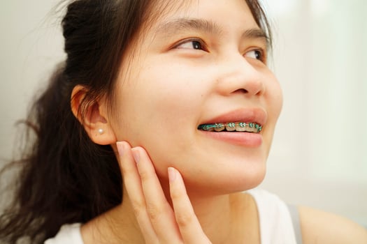 Asian woman with dental braces orthodontic treatment dental care. photo