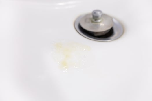 Phlegm or Virus in washbasin photo