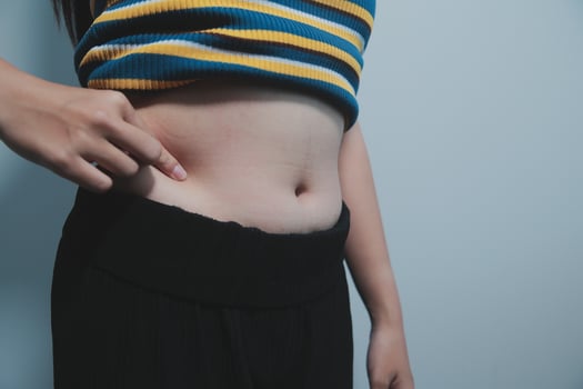 A woman with a belly showing off her stomach photo