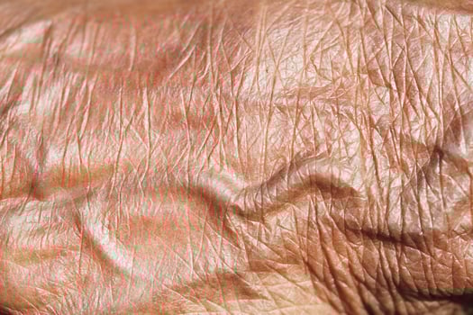 Details of aged skin showcasing wrinkles and texture in natural light photo