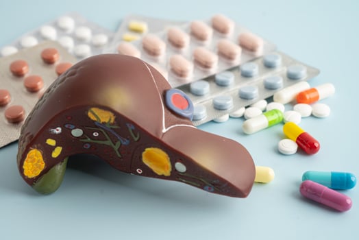 Liver model with pill drug treatment, photo