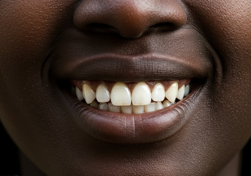 A radiant smile reveals healthy, white teeth against smooth, dark skin in this close-up. photo