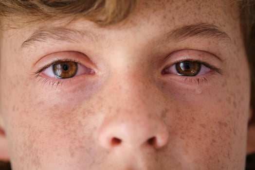 Crop crying child with freckles on face skin photo