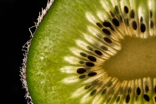 Fresh kiwi fruit texture on black background photo