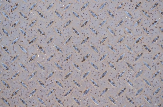 Textured Metal Surface with Diamond Pattern photo