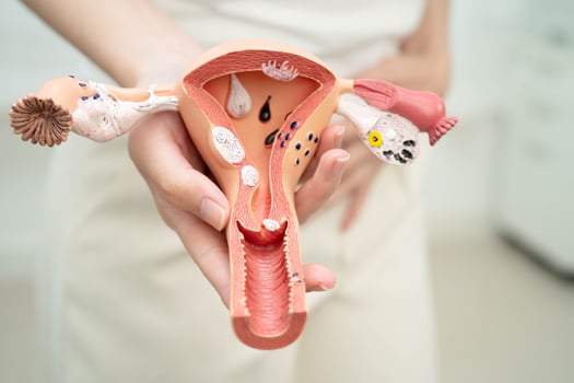 Uterus, Asian, woman holding human photo