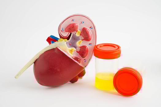 Urinalysis, Kidney and urine cup for check health examination in labor photo