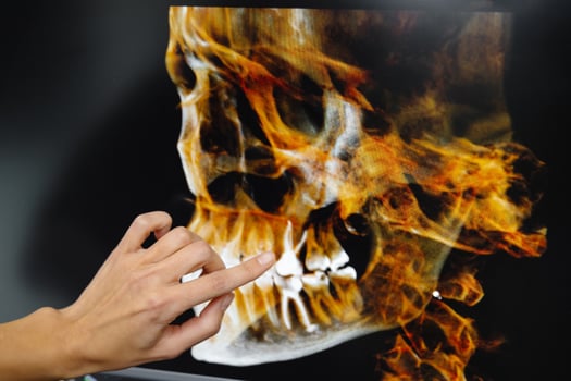 The dentist shows the patient his x-ray of the jaw. Panoramic shot of teeth on the screen at dentist. photo